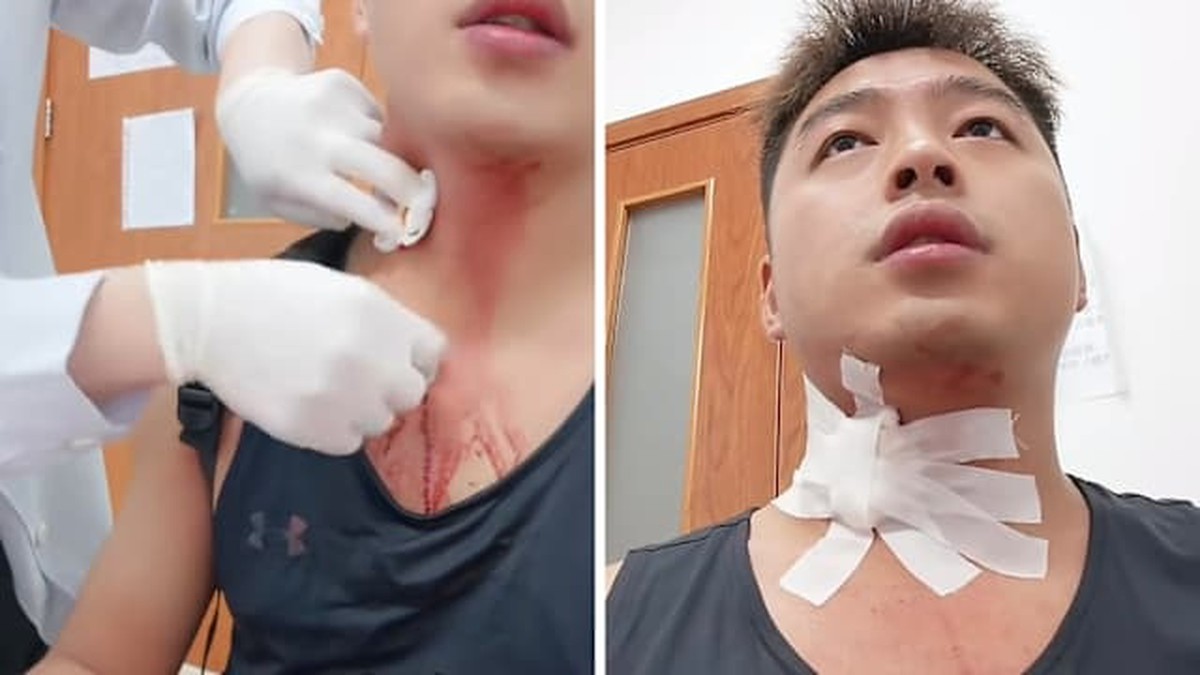 Sự Cố Hy Hữu: Đập Muỗi Gây Chảy Máu Khủng Khiếp Tại Trung Quốc